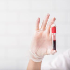 blood test tube for insulin resistance and blood sugar