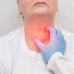 nodular goiter nodules on thyroid gland hyperthyroidism