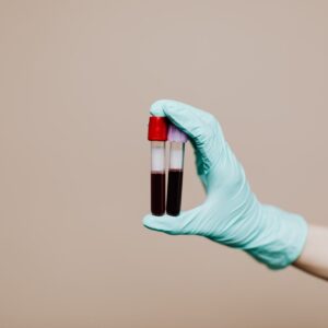 lab tests blood lab test viral infection covid 19