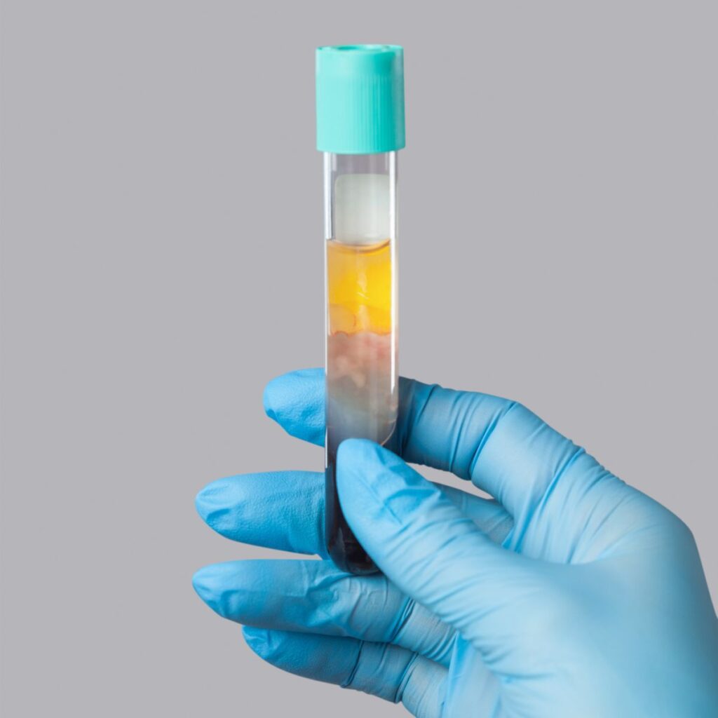 stem cells diet regeneration