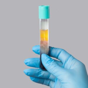 stem cells diet regeneration