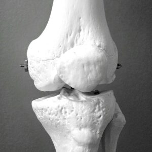 women bone health
