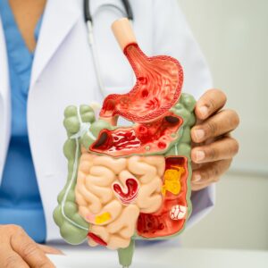 gut health and sibo symptoms microbiome